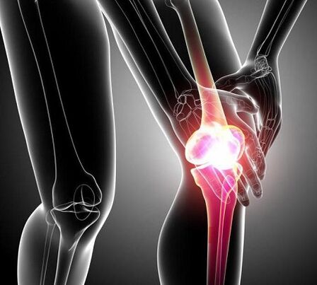 ураження колінного суглоба при артриті і артрозі